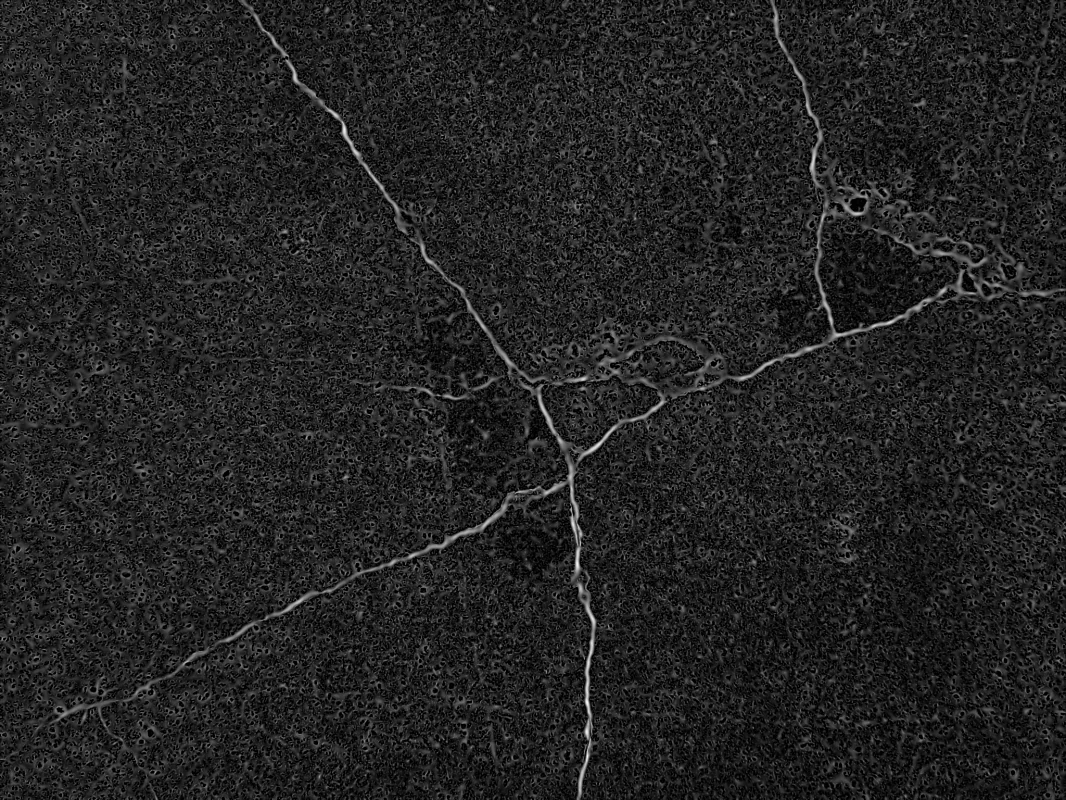 Filter Image Using Meijering 1